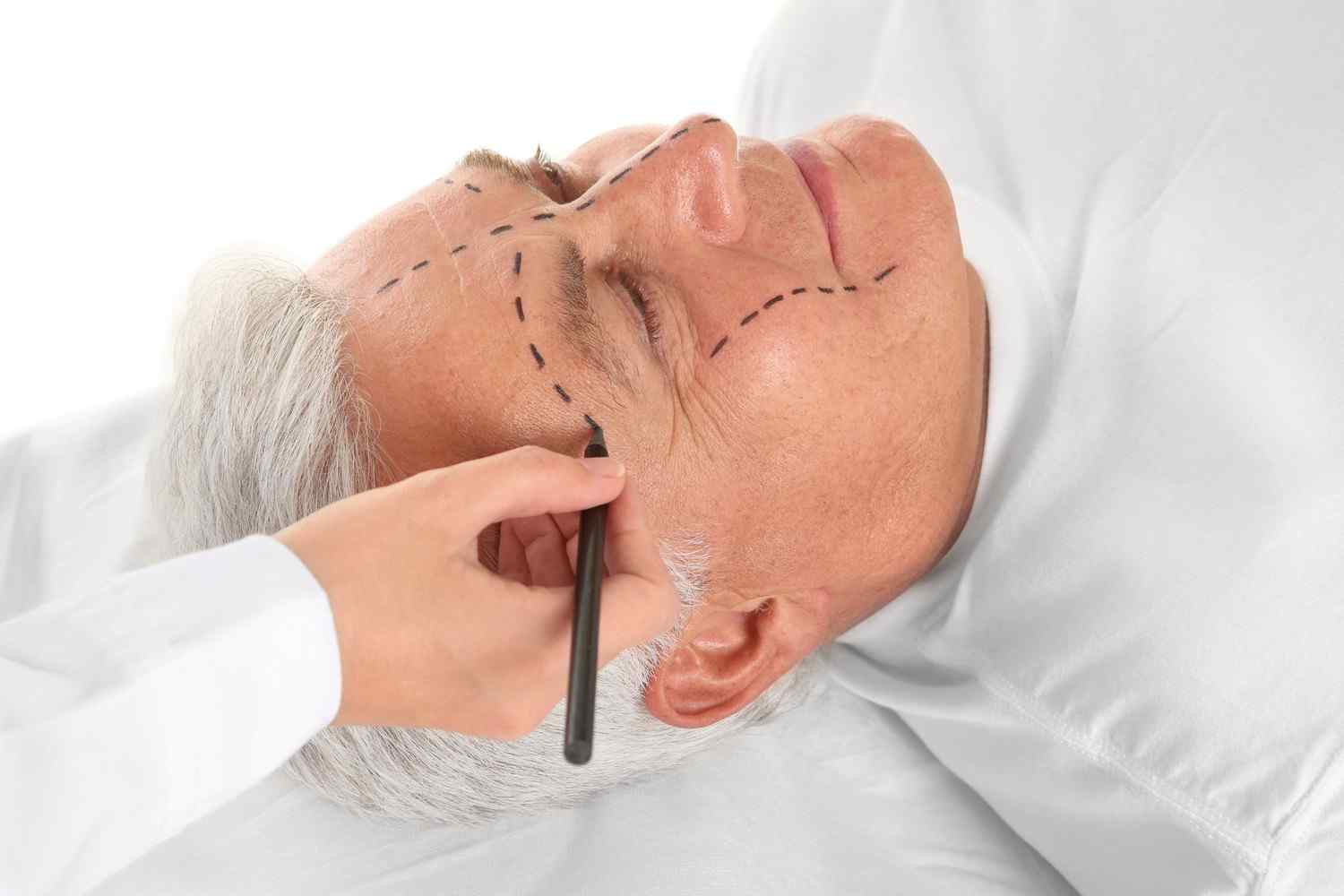 https://lotusmedicalinternational.com/wp-content/uploads/2017/08/cosmetic-surgery-blog-03.jpg