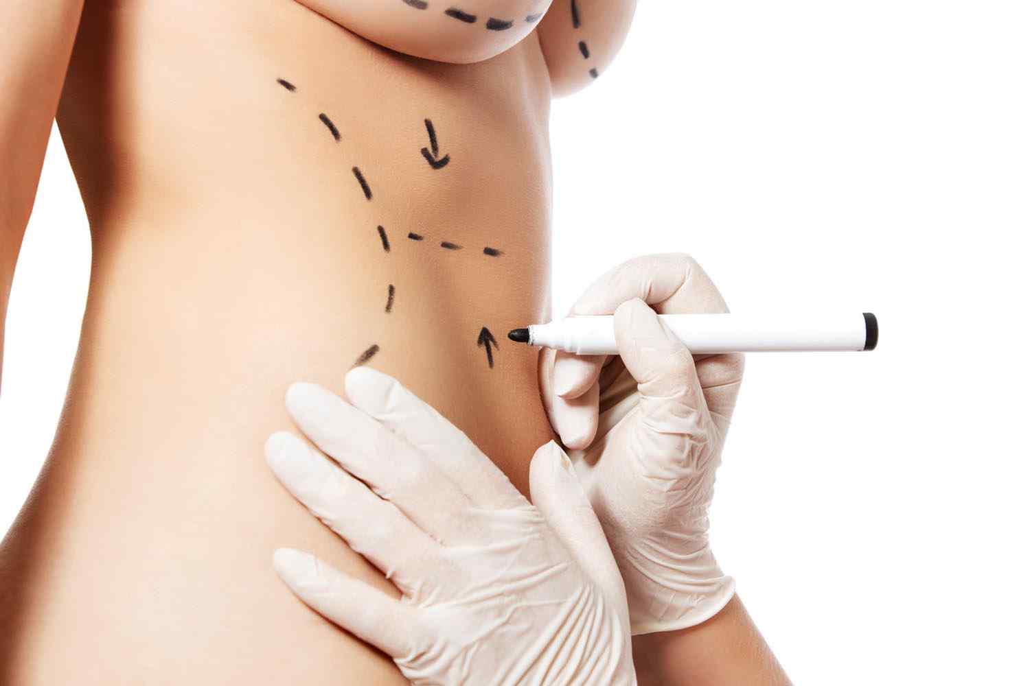 https://lotusmedicalinternational.com/wp-content/uploads/2017/08/cosmetic-surgery-blog-11.jpg