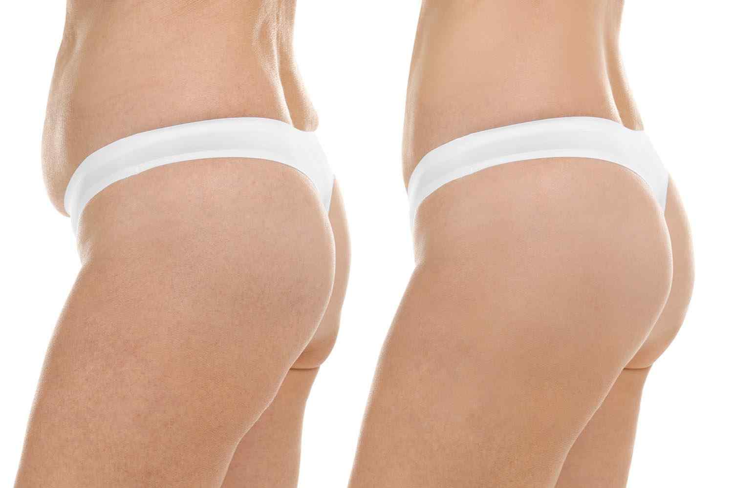 cosmetic-surgery-blog-18 cosmetic-surgery-blog-18