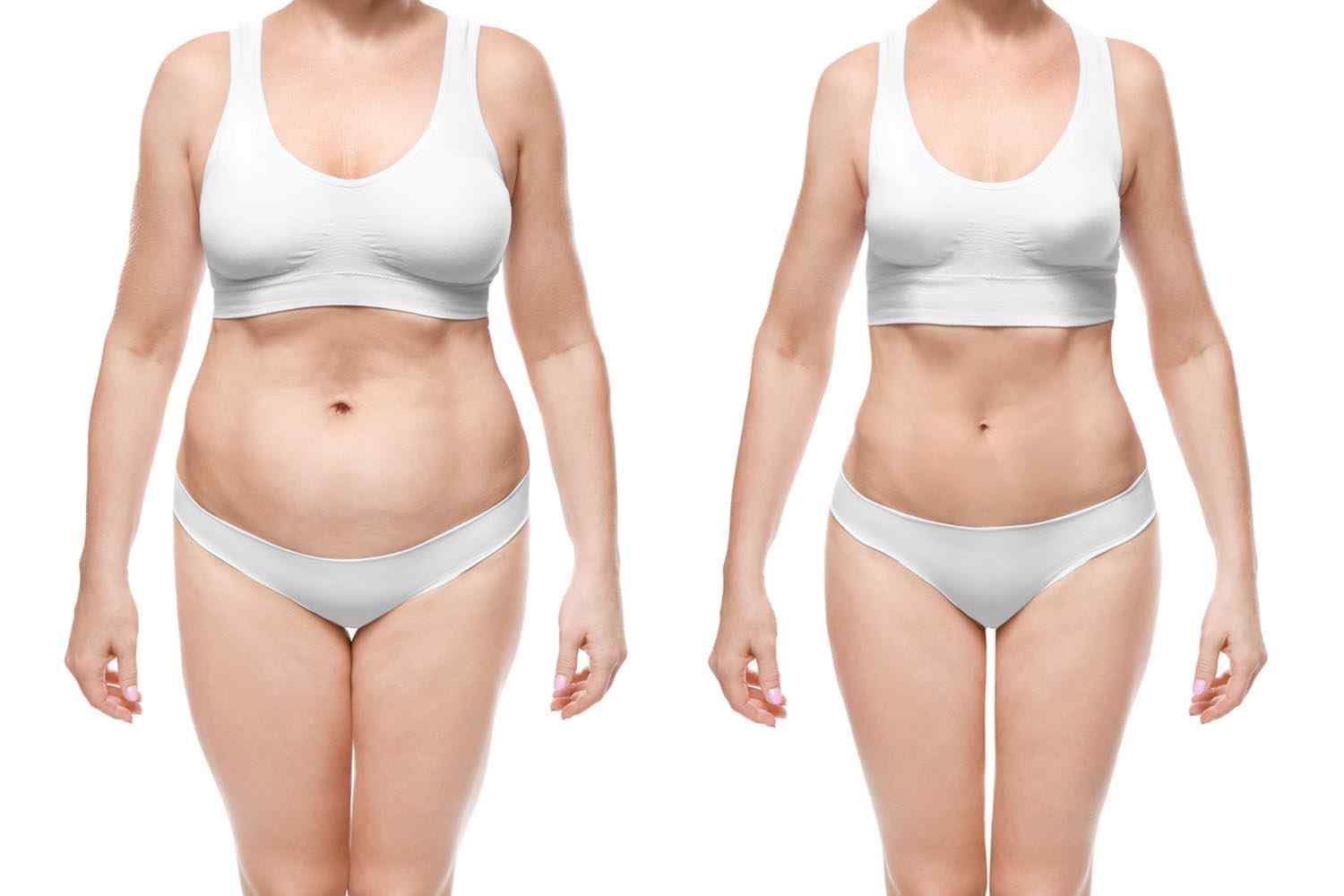 https://lotusmedicalinternational.com/wp-content/uploads/2017/08/cosmetic-surgery-blog-24.jpg