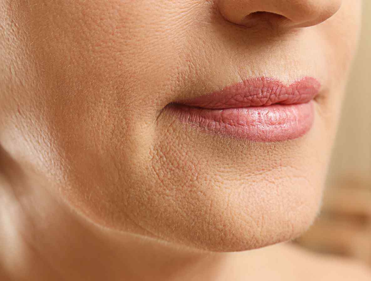 Facelift Lotus Medical International