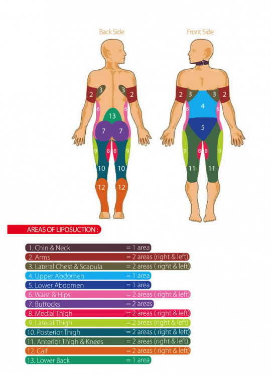 Laser Liposuction Thailand Lotus Medical International