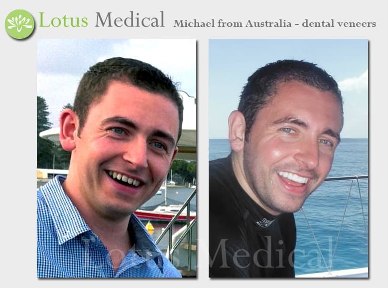 Michael-Bangkok-Dentist.jpg